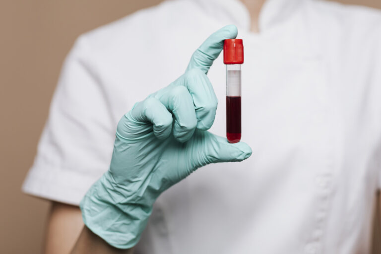 Como armazenar plasma, plaquetas e crioprecipitado com segurança