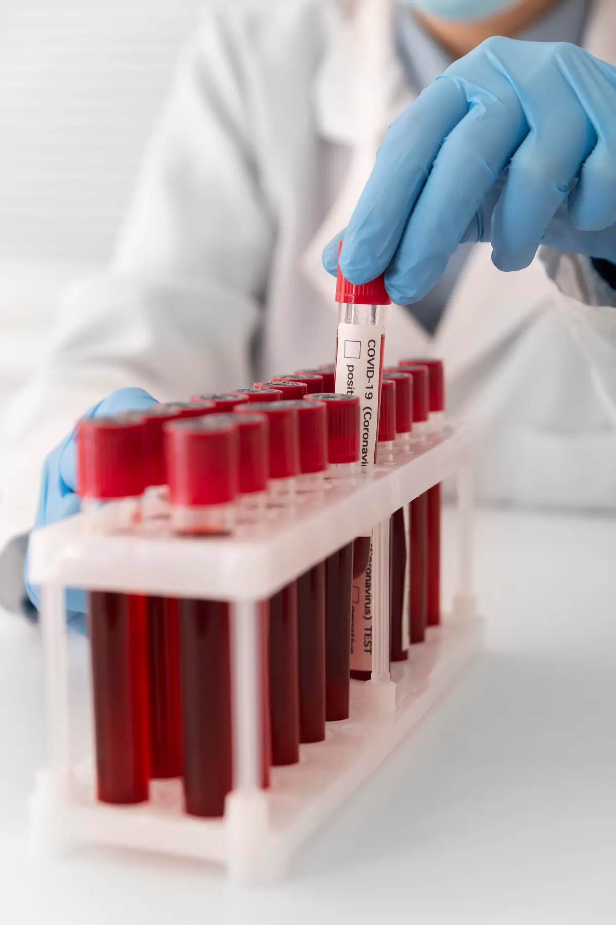 banco de sangue monitorado pela Sensorweb