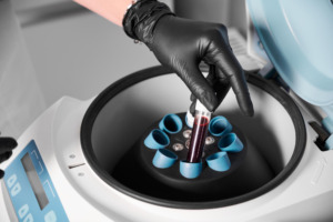 Equipamentos essenciais para armazenar e refrigerar sangue com segurança
