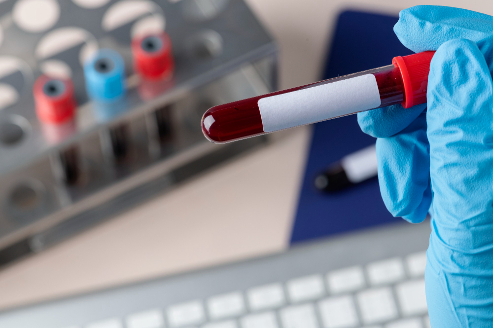 equipamentos para armazenamento e refrigeração do sangue