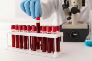 Controle de temperatura em bancos de sangue: segurança e eficiência
