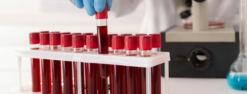Análise de tubos de sangue refrigerados