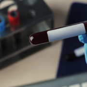 Armazenamento de sangue: práticas essenciais para segurança e eficácia