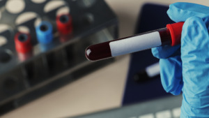 Armazenamento de sangue: práticas essenciais para segurança e eficácia